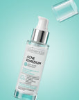 Bielenda ACNE REMEDIUM Smoothing serum reducing imperfections 30ml - Bielenda - Vesa Beauty