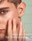 HealthLabs Care AcneSerum for face AHA 5% - Solve On 30ml - HealthLabs Care - Vesa Beauty