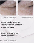 Natural Cosmetics 20 SECONDS MAGIC EYE TREATMENT lifting-repairing transformative undereye & eyelid serum with caffeine, peptides, hyaluronic acid & Beautifeye™ complex 15ml