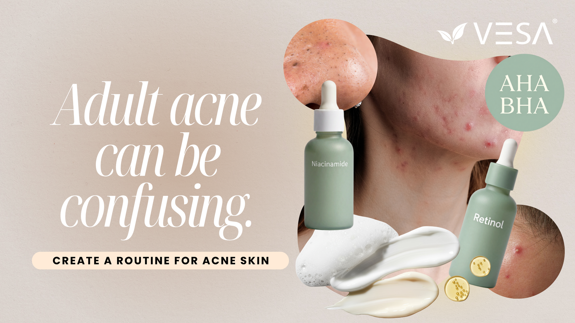 Discover why adult acne appears after the age of 25 and how to care for blemish-prone skin. Learn about effective ingredients, skincare mistakes and a simple daily routine.