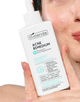 Bielenda ACNE REMEDIUM Sebum - regulating blackhead remover concentrate 130ml - Bielenda - Vesa Beauty