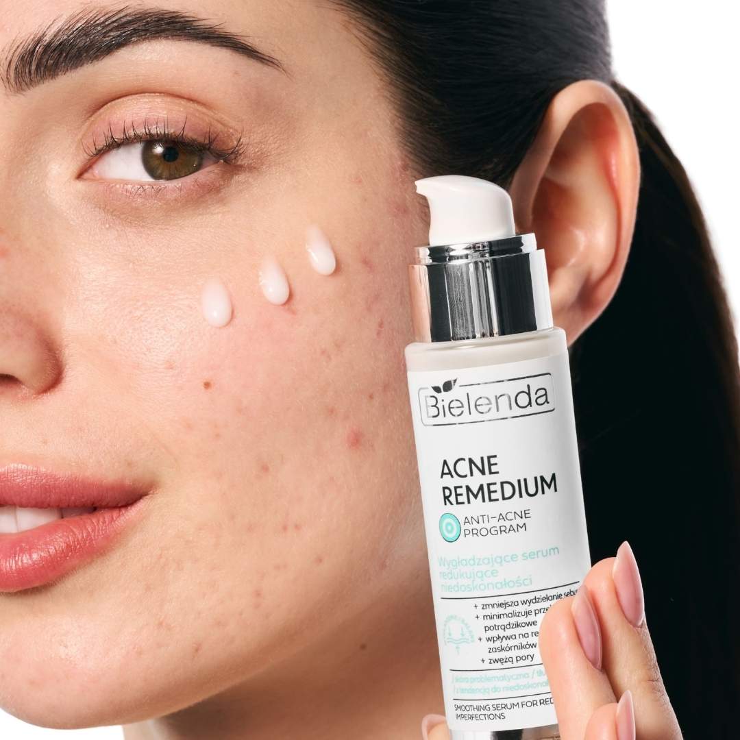 Bielenda ACNE REMEDIUM Smoothing serum reducing imperfections 30ml - Bielenda - Vesa Beauty