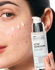 Bielenda ACNE REMEDIUM Smoothing serum reducing imperfections 30ml - Bielenda - Vesa Beauty