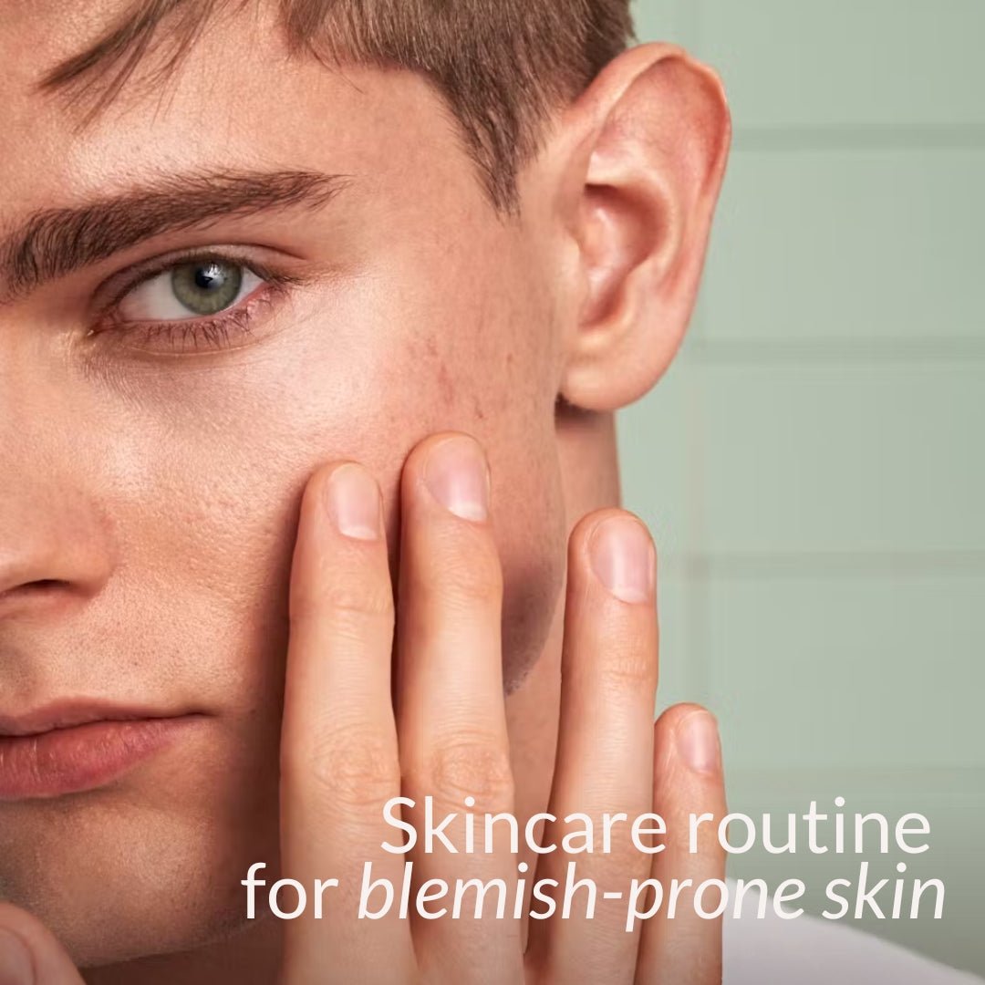 HealthLabs Care AcneSerum for face AHA 5% - Solve On 30ml - HealthLabs Care - Vesa Beauty