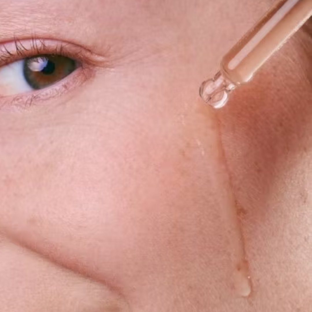 Tołpa dermo face enzyme. Serum - killer of blackheads 30ml - Tołpa - Vesa Beauty