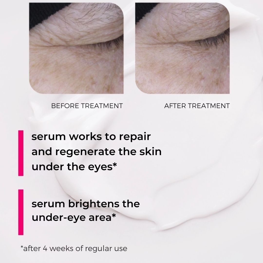 Natural Cosmetics 20 SECONDS MAGIC EYE TREATMENT lifting-repairing transformative undereye & eyelid serum with caffeine, peptides, hyaluronic acid & Beautifeye™ complex 15ml